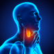 A graphical image of a man with throat cancer.